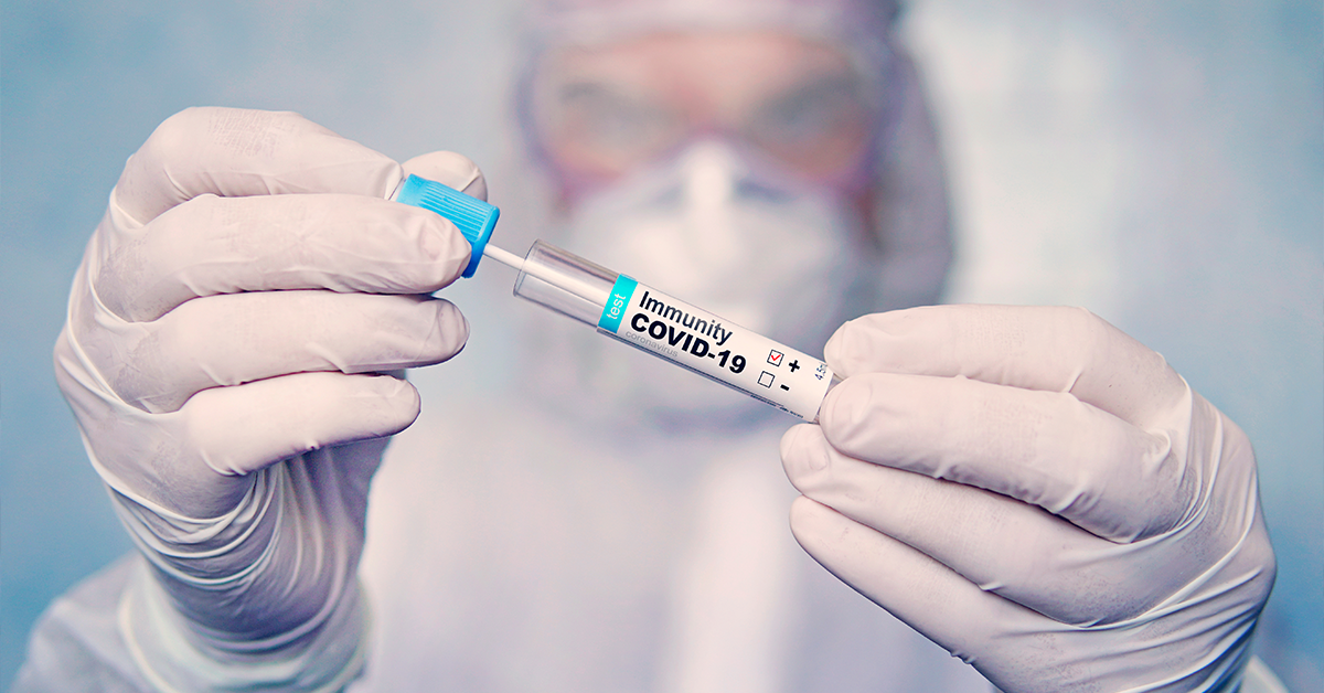 Modification Army Contract for Coronavirus Antibody Production